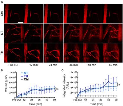 Moderate systemic therapeutic hypothermia is insufficient to protect blood-spinal cord barrier in spinal cord injury